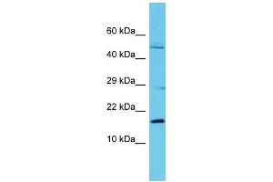 Host: Rabbit Target Name: C8orf44 Sample Type: Fetal Kidney lysates Antibody Dilution: 1. (C8ORF44 antibody  (N-Term))