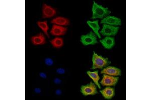 ABIN7094814 and ABIN7098865 staining Hela cells by IF/ICC. (Filaggrin antibody  (C-Term))
