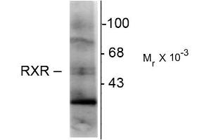 Western blots of hippocampal lysate showing immunolabeling of the ~48k RXR-( isotype. (Retinoid X Receptor gamma antibody)
