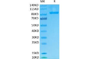 Biotinylated Human FAP on Tris-Bis PAGE under reduced conditions. (FAP Protein (His-Avi Tag,Biotin))