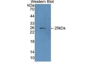 Detection of Recombinant HMGCS2, Human using Polyclonal Antibody to Hydroxymethylglutaryl Coenzyme A Synthase 2, Mitochondrial (HMGCS2) (Hydroxymethylglutaryl Coenzyme A Synthase 2, Mitochondrial (AA 1-167) antibody)