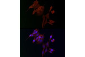 Immunofluorescence analysis of NIH/3T3 cells using  Rabbit pAb (ABIN3016805, ABIN3016806, ABIN3016807 and ABIN6219845) at dilution of 1:100. (ADAMTS5 antibody  (AA 731-930))