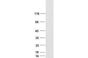 Validation with Western Blot (PPFIBP1 Protein (Transcript Variant 1) (Myc-DYKDDDDK Tag))