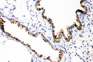 Anti- GST3/GST pi Picoband antibody, IHC(P) IHC(P): Rat Lung Tissue (GSTP1 antibody  (AA 2-210))