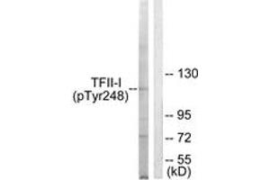 Western blot analysis of extracts from LOVO cells, using TFII-I (Phospho-Tyr248) Antibody. (GTF2I antibody  (pTyr248))