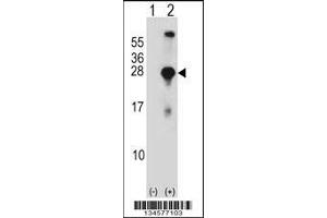 Western blot analysis of SNAP23 using rabbit polyclonal SNAP23 Antibody using 293 cell lysates (2 ug/lane) either nontransfected (Lane 1) or transiently transfected (Lane 2) with the SNAP23 gene. (SNAP23 antibody  (C-Term))