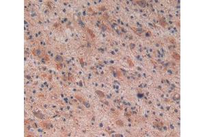 Used in DAB staining on fromalin fixed paraffin- embedded glioma tissue (Reelin antibody  (AA 26-190))