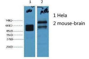 Western Blot (WB) analysis of 1) HeLa, 2) Mouse Brain, diluted at 1:4000. (KRT8 antibody)