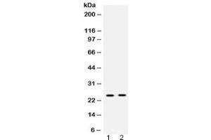 Western blot testing of 1) rat liver and 2) human placenta lysate with HMGB2 antibody at 0.