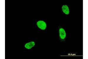 Immunofluorescence of monoclonal antibody to HOXA5 on HeLa cell. (HOXA5 antibody  (AA 171-270))