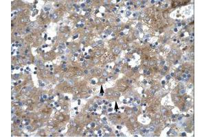 Image no. 1 for anti-Zinc Finger Protein 81 (ZNF81) (C-Term) antibody (ABIN202859) (ZNF81 antibody  (C-Term))