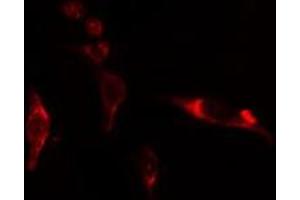Immunofluorescence (fixed cells) (IF/ICC) image for anti-Eukaryotic Translation Initiation Factor 3, Subunit D (EIF3D) (Internal Region) antibody (ABIN6258372)