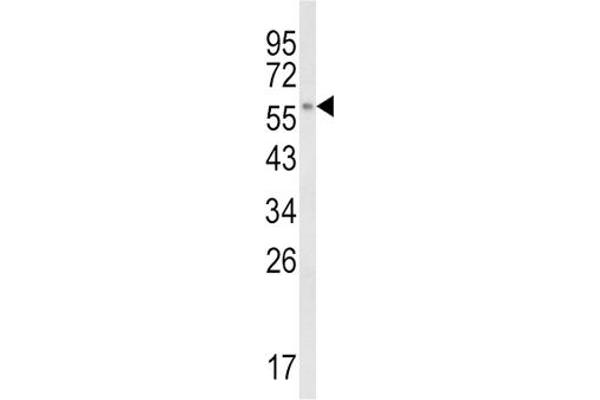 CYP8B1 antibody