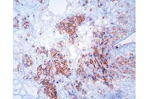 anti-Guanine Nucleotide Binding Protein (G Protein), beta Polypeptide 1 (GNB1) (AA 2-42), (N-Term) antibody