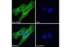 ABIN185467 Immunofluorescence analysis of paraformaldehyde fixed U2OS cells, permeabilized with 0. (SCN5A antibody  (Internal Region))