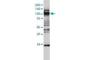 GTF3C2 monoclonal antibody (M01), clone 1C6-2B8 Western Blot analysis of GTF3C2 expression in Hela S3 NE . (GTF3C2 antibody  (AA 1-911))