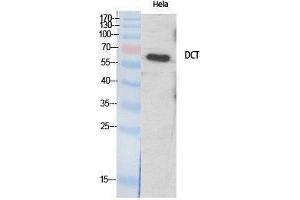 Western Blotting (WB) image for anti-Dopachrome Tautomerase (DCT) (Internal Region) antibody (ABIN3187350) (DCT antibody  (Internal Region))