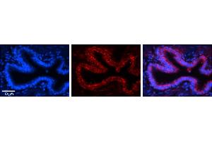 Rabbit Anti-RPLP0 Antibody     Formalin Fixed Paraffin Embedded Tissue: Human Bronchial Epithelial Tissue  Observed Staining: Cytoplasmic  Primary Antibody Concentration: 1:100  Secondary Antibody: Donkey anti-Rabbit-Cy3  Secondary Antibody Concentration: 1:200  Magnification: 20X  Exposure Time: 0. (RPLP0 antibody  (N-Term))