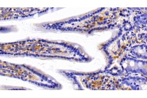 Immunohistochemistry (IHC) image for anti-Caveolin 1, Caveolae Protein, 22kDa (CAV1) (AA 2-104) antibody (ABIN7431320)