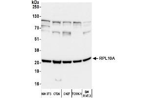 Western Blotting (WB) image for anti-Ribosomal Protein L10a (RPL10A) (AA 50-100) antibody (ABIN7450674)
