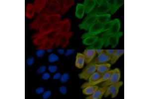 ABIN6258746 and ABIN6273920 staining Hela cells(30 min of UV treatment) by IF/ICC. (FZD10 antibody  (Internal Region))
