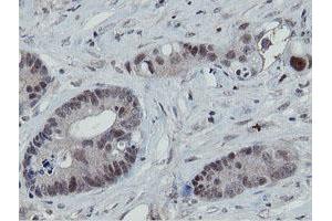 Image no. 12 for anti-Mitochondrial Intermediate Peptidase (MIPEP) (AA 174-516) antibody (ABIN1491016)