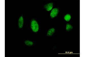 Immunofluorescence of purified MaxPab antibody to ID1 on HeLa cell. (ID1 antibody  (AA 1-155))