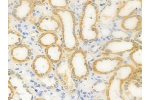 ABIN6263558 and ABIN6277573 at 1/100 staining human normal kidney tissue by IHC-P.