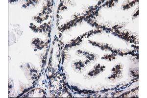 Immunohistochemical staining of paraffin-embedded Human prostate tissue using anti-ACY3 mouse monoclonal antibody. (Aminoacylase 3 antibody)