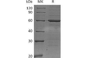 IRF5 Protein (His tag)