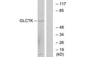 Western blot analysis of extracts from NIH-3T3 cells, using GLCTK Antibody. (GLYCTK antibody  (AA 101-150))