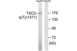 Western Blotting (WB) image for anti-Tuberous Sclerosis 2 (TSC2) (AA 1537-1586), (pTyr1571) antibody (ABIN482799) (Tuberin antibody  (pTyr1571))