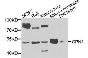 Western blot analysis of extracts of various cells, using CPN1 antibody.