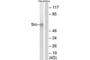 Western blot analysis of extracts from HeLa cells, using Src (Ab-529) Antibody. (Src antibody  (AA 487-536))