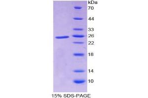 SDS-PAGE analysis of Human ADAMTS1 Protein. (ADAMTS1 Protein)