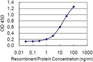 Detection limit for recombinant GST tagged DAB2IP is 0. (DAB2IP antibody  (AA 551-650))