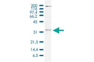 Western Blot (Cell lysate) analysis of 20 ug nuclear extracts of HeLa cells. (WDR61 antibody)