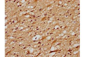 IHC image of ABIN7149649 diluted at 1:700 and staining in paraffin-embedded human brain tissue performed on a Leica BondTM system. (DLL3 antibody  (AA 27-492))