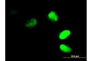 Immunofluorescence of monoclonal antibody to FRG1 on HeLa cell.