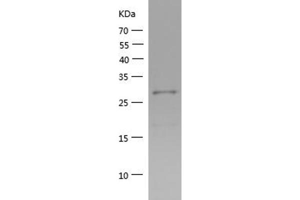 MAVS Protein (AA 237-513) (His tag)