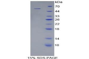 SDS-PAGE analysis of Human Kallikrein 6 Protein.