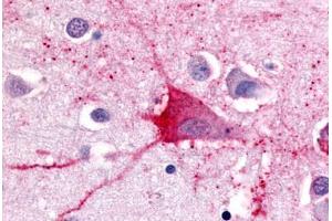 Anti-TRH Receptor antibody  ABIN1049426 IHC staining of human brain, neurons and glia.