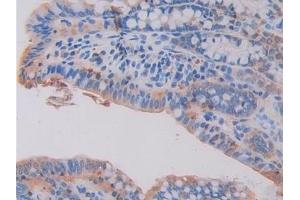 Immunohistochemistry (IHC) image for anti-Hexosaminidase B (Beta Polypeptide) (HEXB) (AA 294-435) antibody (ABIN7438139)