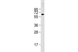 Western blot testing of human HepG2 cell lysate with PTH1R antibody at 1:2000. (PTH1R antibody  (AA 52-86))