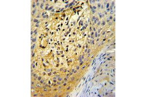 Formalin-fixed and paraffin-embedded human skin tissue reacted with SPARC Antibody , which was peroxidase-conjugated to the secondary antibody, followed by DAB staining. (SPARC antibody  (C-Term))