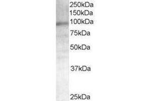 Western Blotting (WB) image for Androgen Receptor (AR) peptide (ABIN370140) (Androgen Receptor (AR) Peptide)