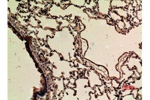 Immunohistochemistry (IHC) analysis of paraffin-embedded Rat Lung, antibody was diluted at 1:100. (NRF2 antibody  (acLys599))