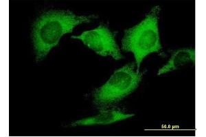 Immunofluorescence of purified MaxPab antibody to DCTN2 on HeLa cell.