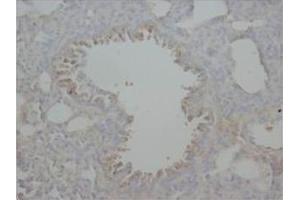 Immunohistochemical analysis of Paraffin-Embedded Rat Tissue Sections (Lung) using RAGE antibody. (RAGE antibody  (Middle Region))