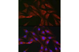 Immunofluorescence analysis of NIH/3T3 cells using SOCS3 Rabbit pAb (ABIN3021099, ABIN3021100, ABIN3021101 and ABIN6213950) at dilution of 1:50 (40x lens).